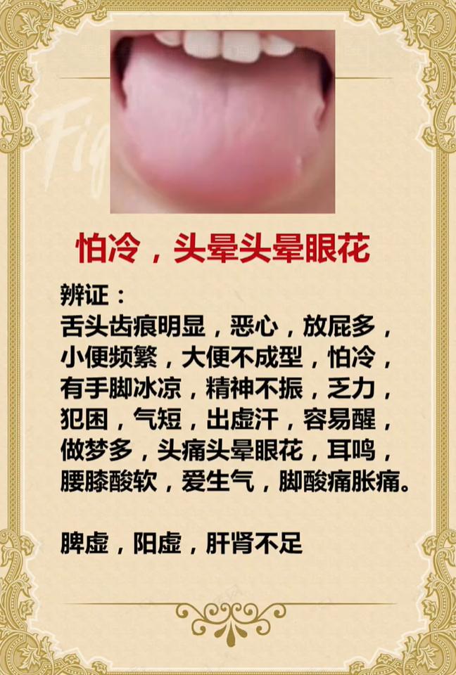 怕冷头晕眼花、浑身乏力？多半是脾虚、阳虚、肝肾不足