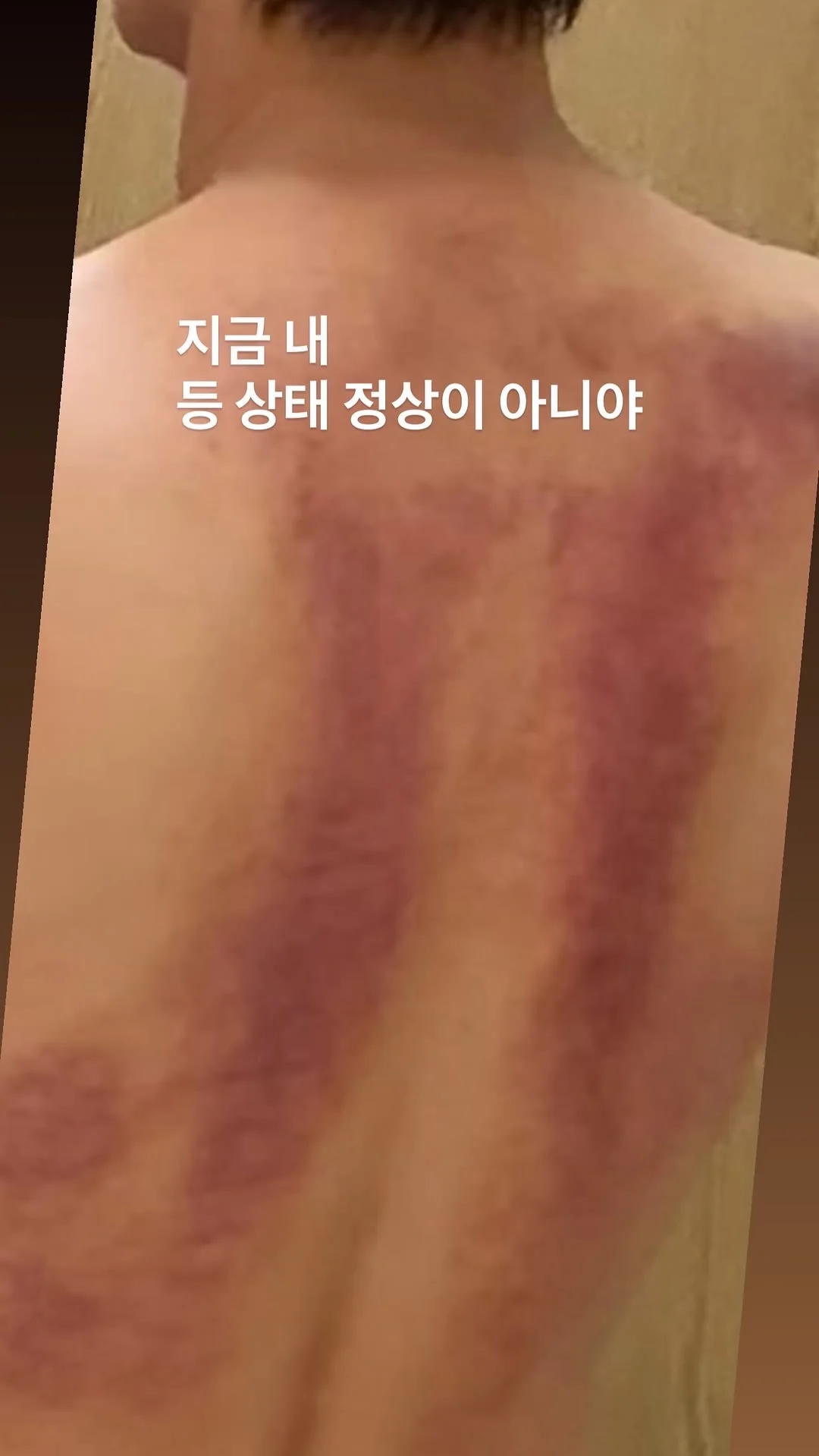 现在我的背状态不太正常