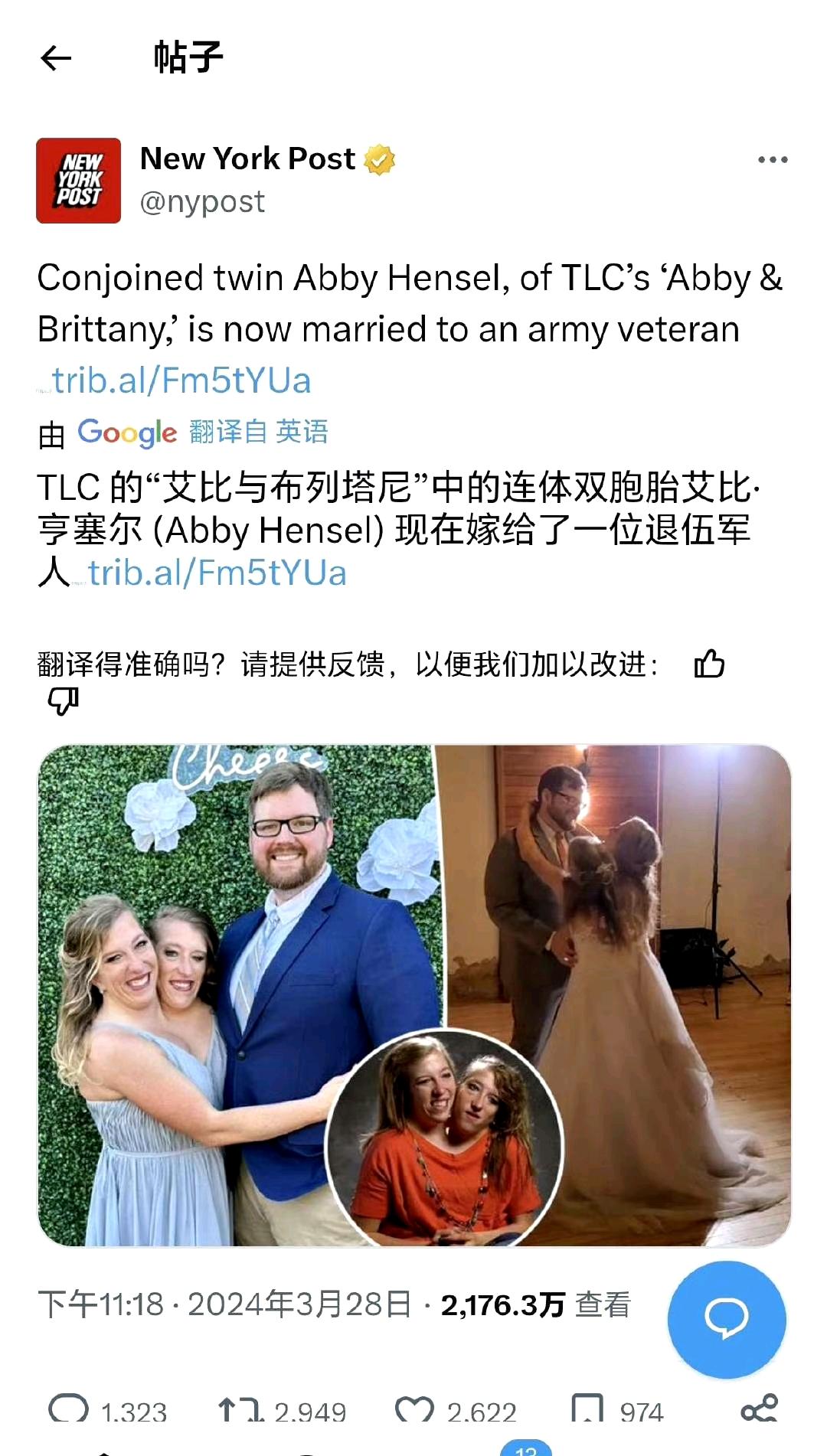 3月28日，美国连体双胞胎姐妹其中一人宣布已婚，引起美国网友热议[抠鼻]
三人结