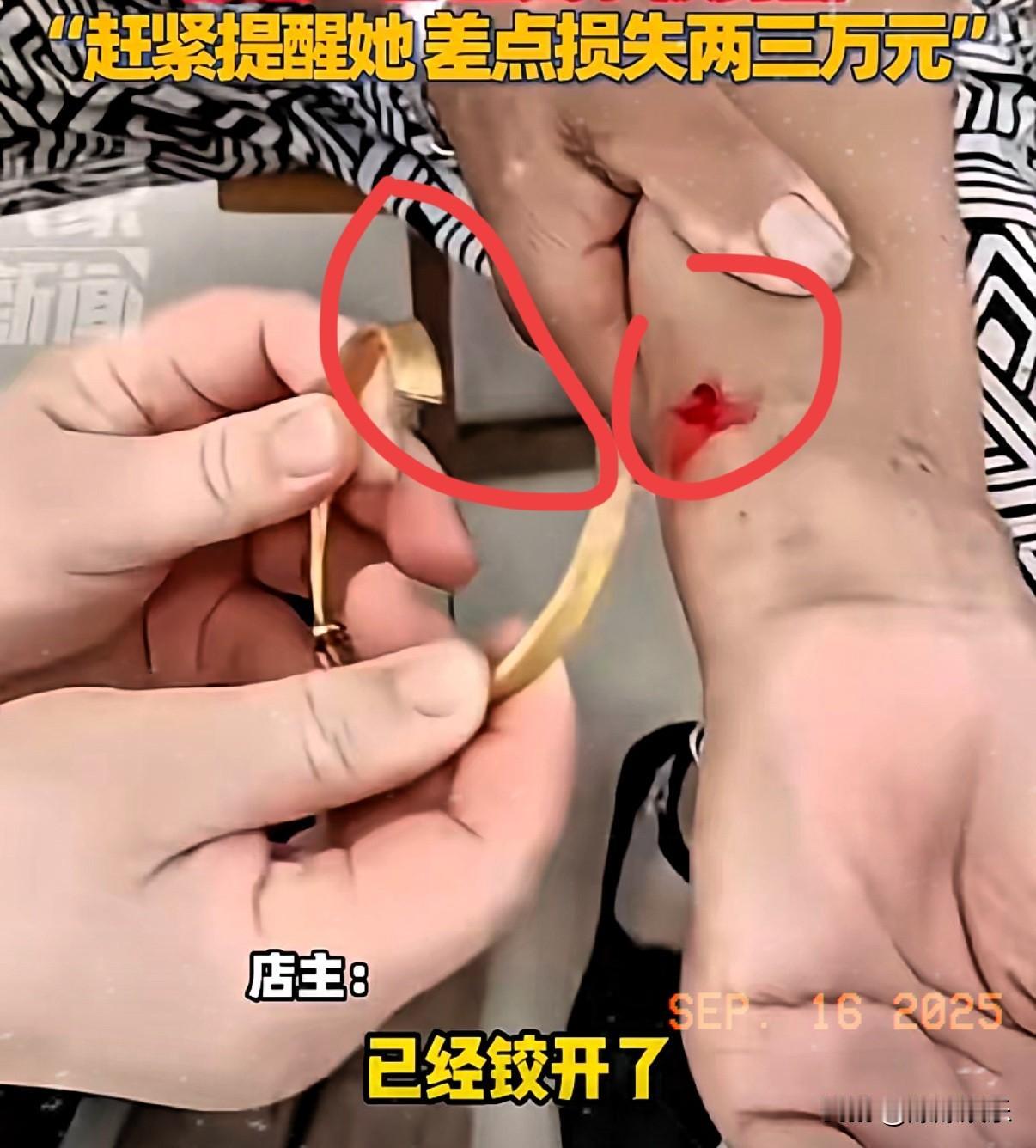 山东威海有位老太太赶集时，走进一家店铺买东西，店主一眼就发现她手腕在流血。仔细一