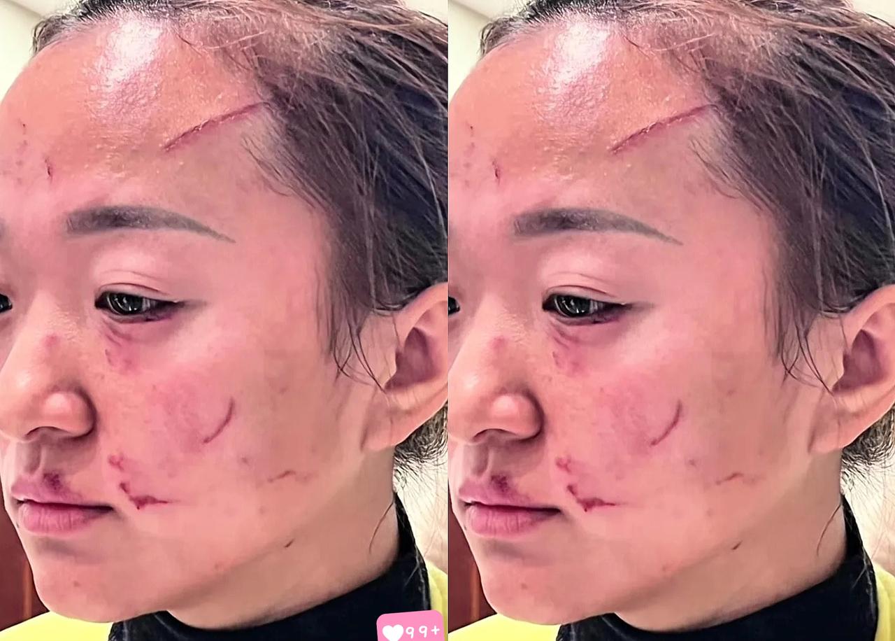 我感觉，现在被调解的媳妇，肯定挺复杂的。
不是因为婆婆给了5万，
而是因为这钱像