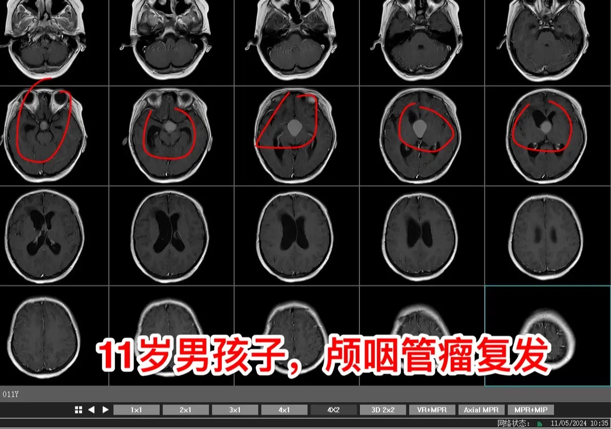 三博论坛圆满结束！2024年是三博脑科医院成立二十周年。       ...