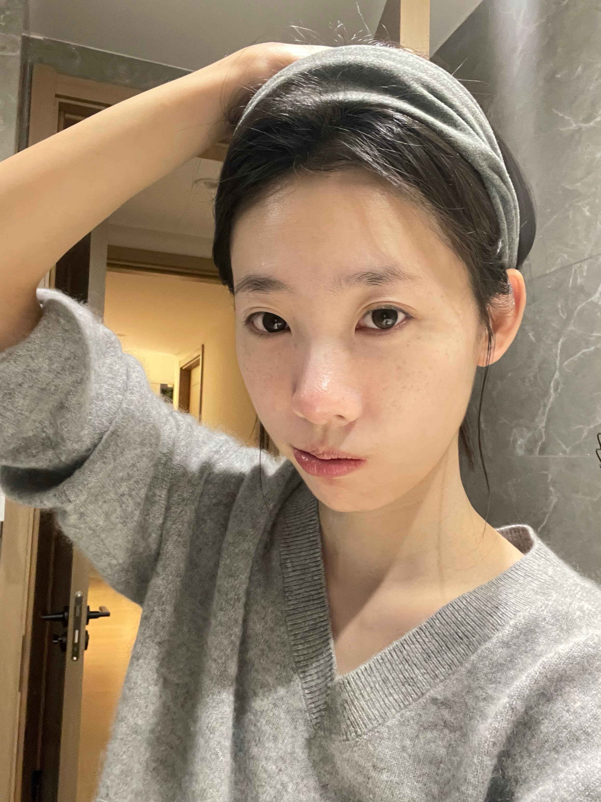 皮肤状态已经很久不长痘了 老了就是说[太开心]记录下24年新冒的色斑 在思考秒不