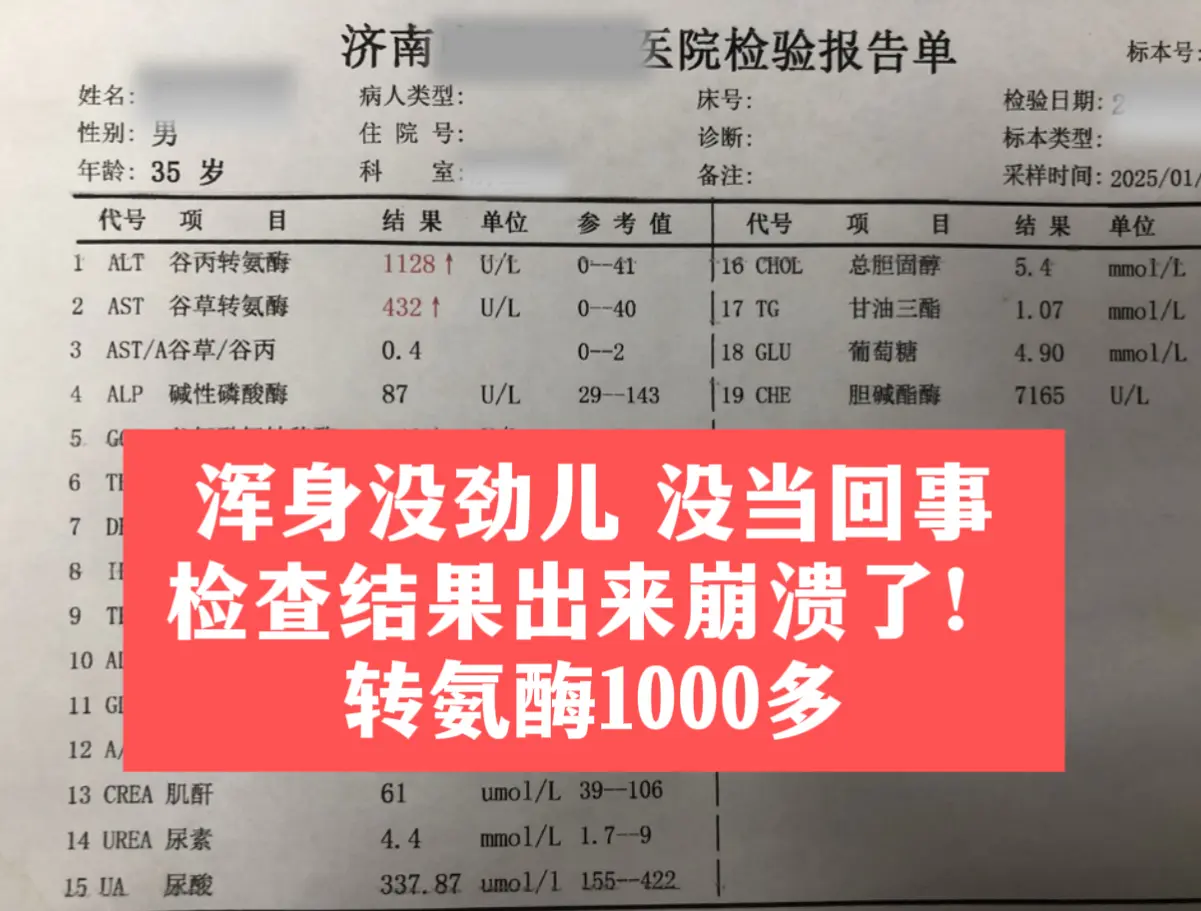 今天门诊来了一位德州来的患者，今年34岁，前两个月总觉得浑身乏力，提不...