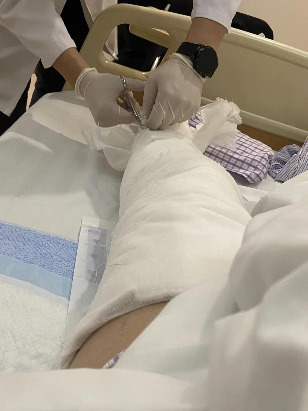 “胆子真大真无知！”黑龙江，一女子得知亲戚腿有毛病，竟然自告奋勇给看病，导致男子