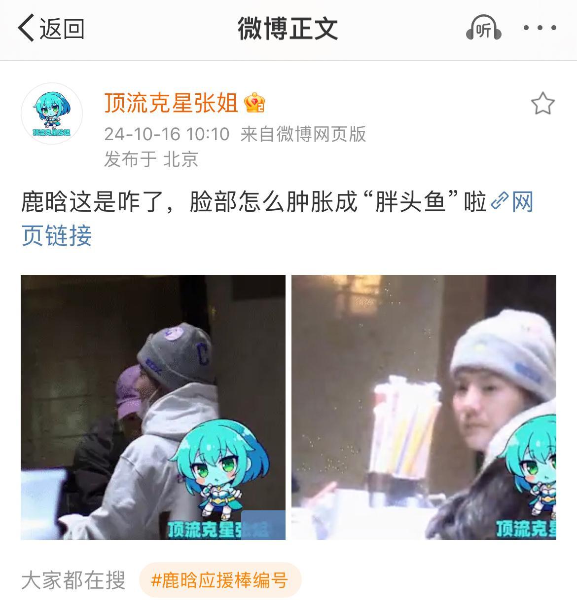 #狗仔说鹿晗脸部肿胀成胖头鱼##狗仔说鹿晗脸肿成胖头鱼# 哪有？挺可爱的 ​​​