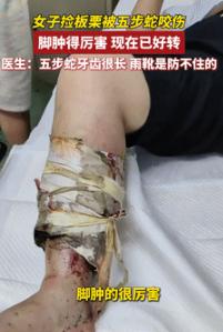 防不胜防！9月17日浙江温州，一女子穿雨靴上山采板栗，本以为这样就安全了，不料，