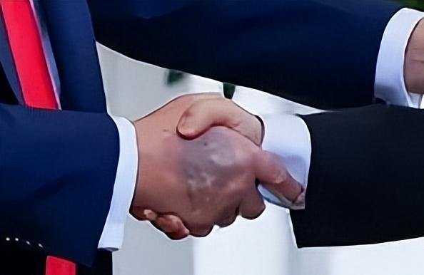 特朗普会见李在明，却被抓拍到手背一大片乌黑淤青！7月份还是小面积时，他还特意涂遮