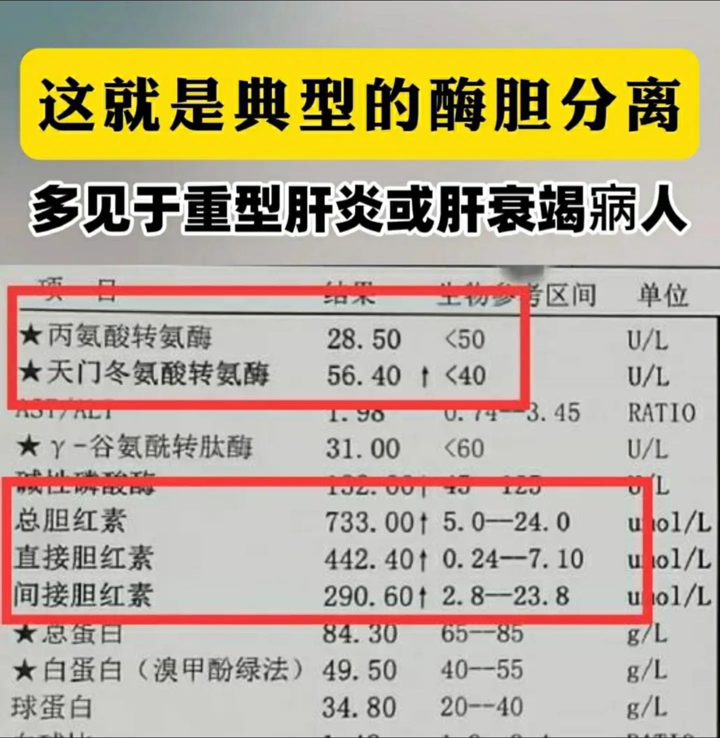 肝功能别只看转氨酶，这个指标升高更可怕！转氨酶正常，胆红素异常升高，甚...