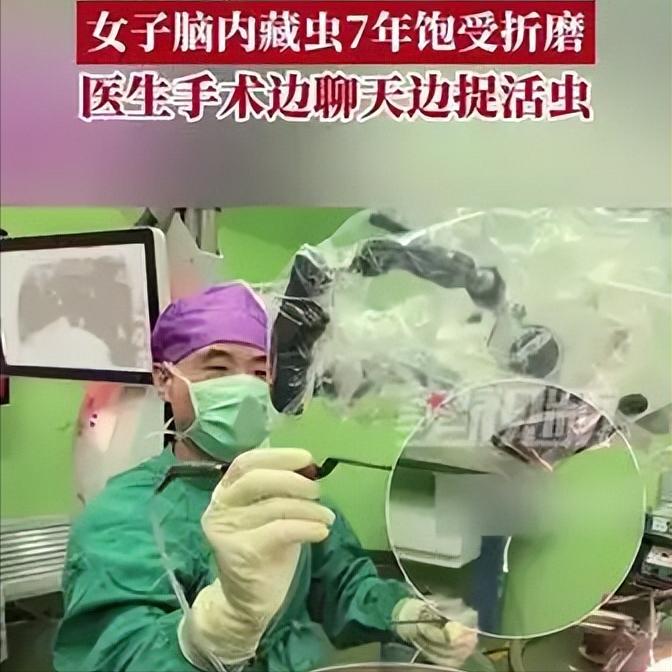 颅内藏虫存活7年！女子清醒开颅，医生靠聊天活捉元凶

你敢信？一名女子大脑里，竟