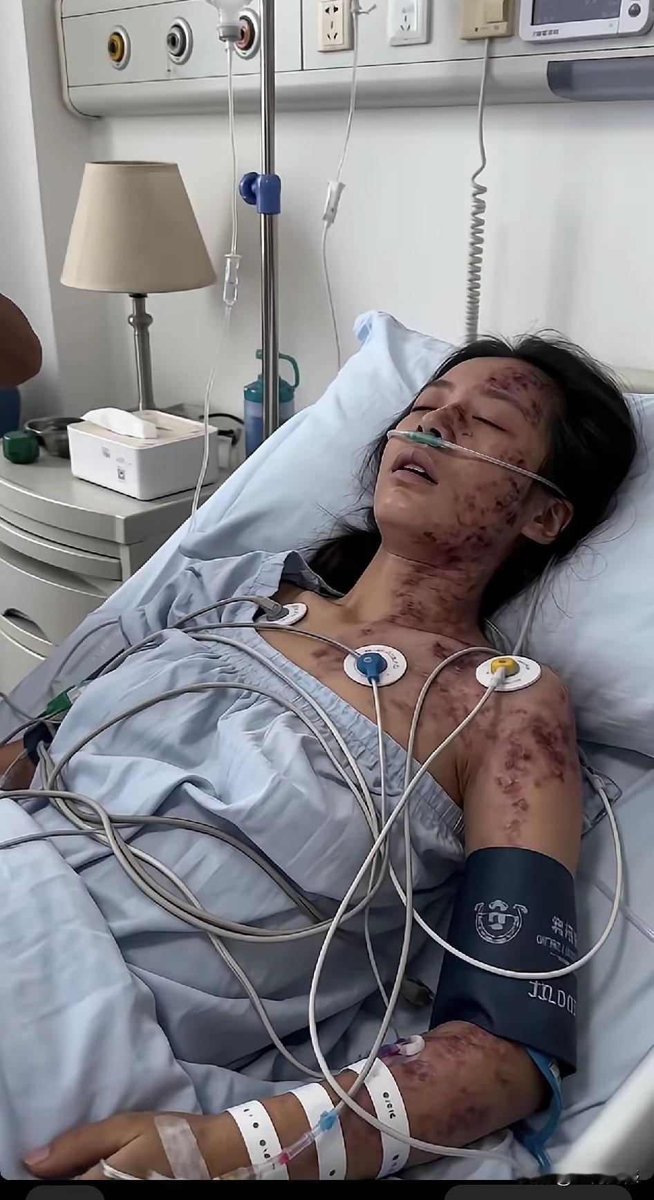 这个漂亮的女子浑身伤痕累累，满身插着管子，鼻子上呼吸着氧气，人好像是昏迷不醒，她