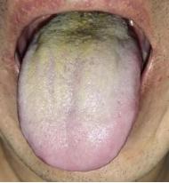 看这个小伙子，明明才二十多岁，却像五十多岁，身体都被他玩坏了！

患者主诉：男科