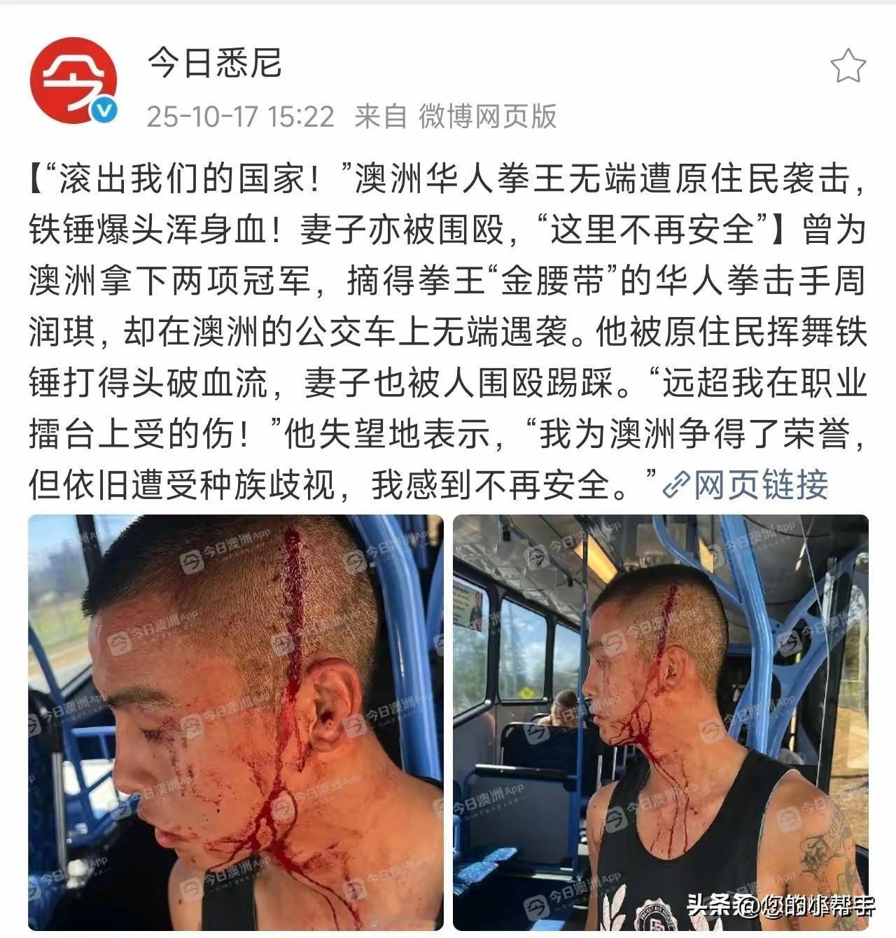 哪种男人是最无能的？
就是那种出了国，手握利器，在被威胁生命，在伴侣有可能受到伤