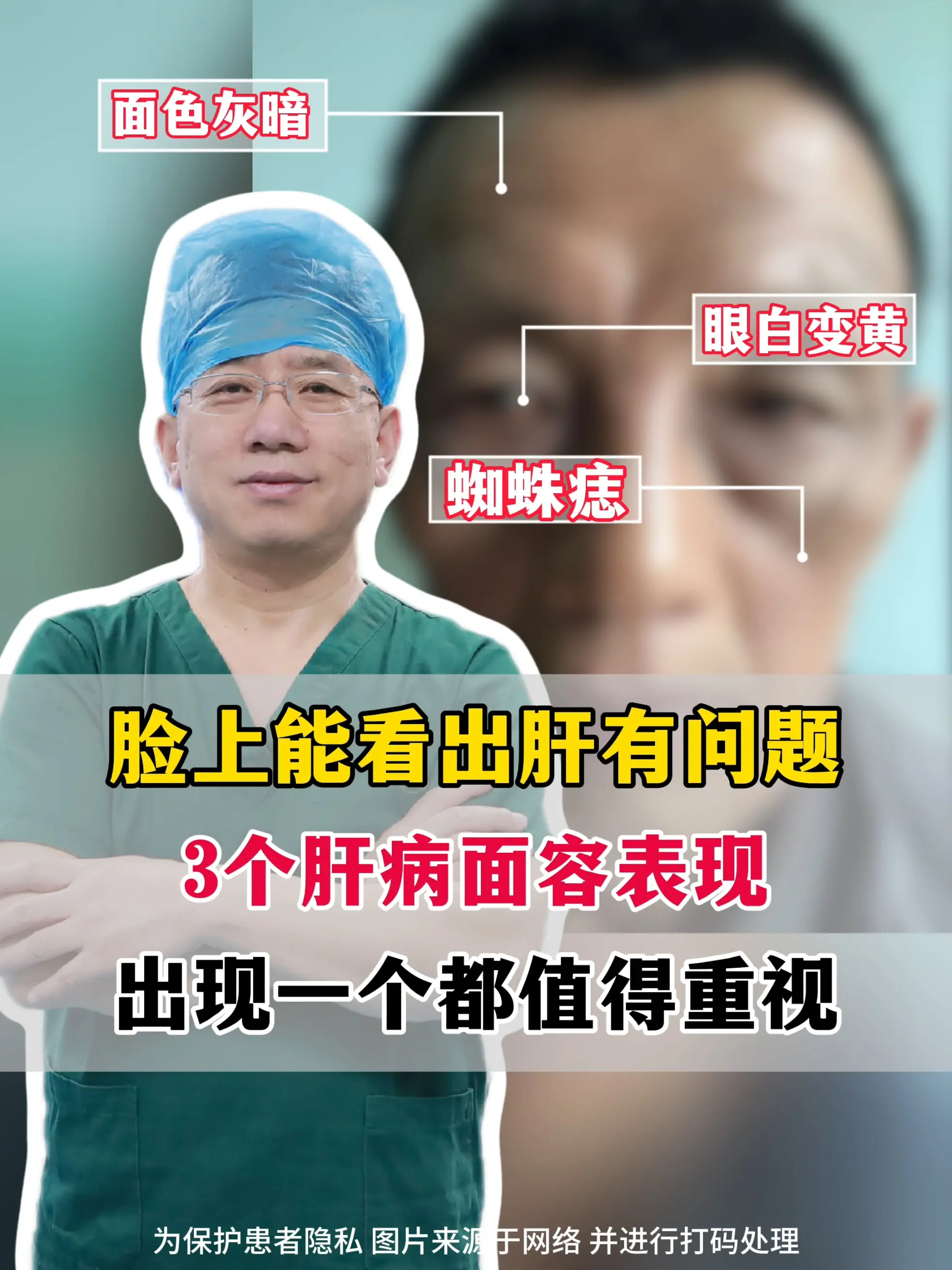 肝病门诊待了 30 多年，有时患者刚进门，我一眼就能看出来：这个人大概...
