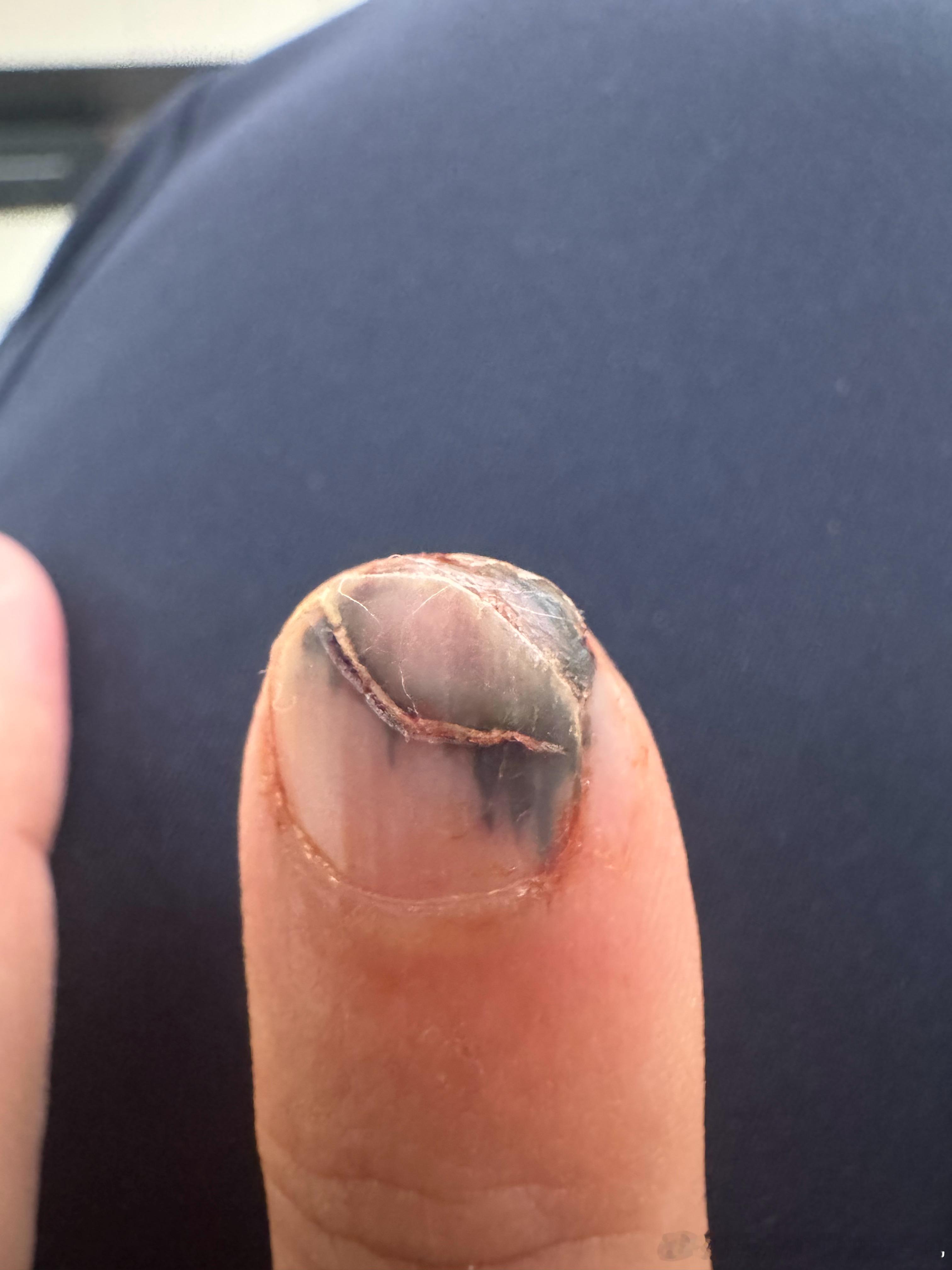 破茧重生中……