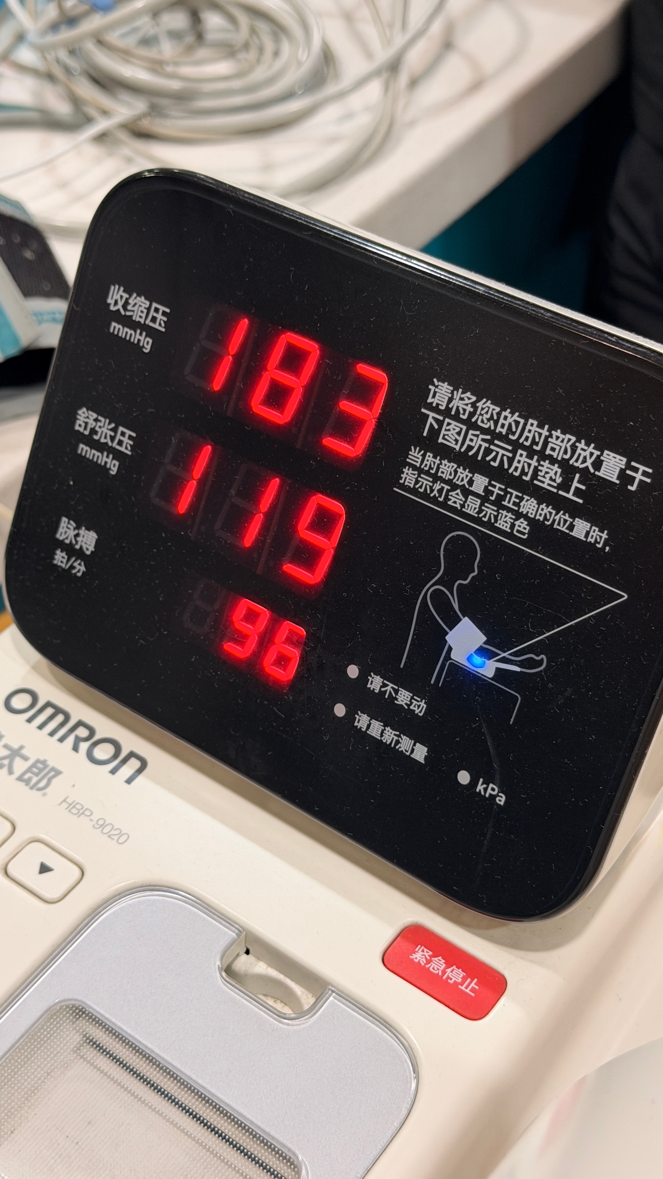 上着班给我干急诊来了！轩哥肾结石急性发作，血压直飙183…现在准备做CT中！！！