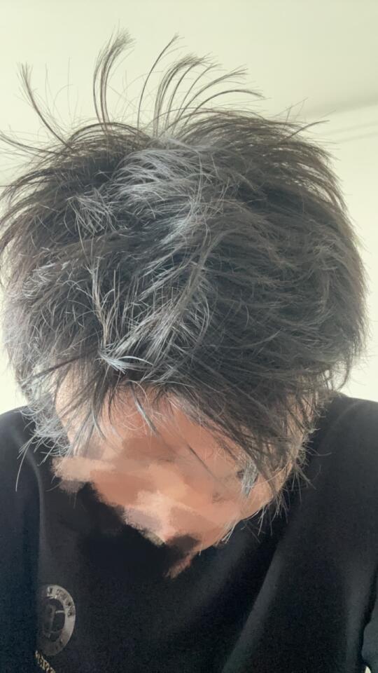 米诺942天 非那115天，发质好像变好了😄