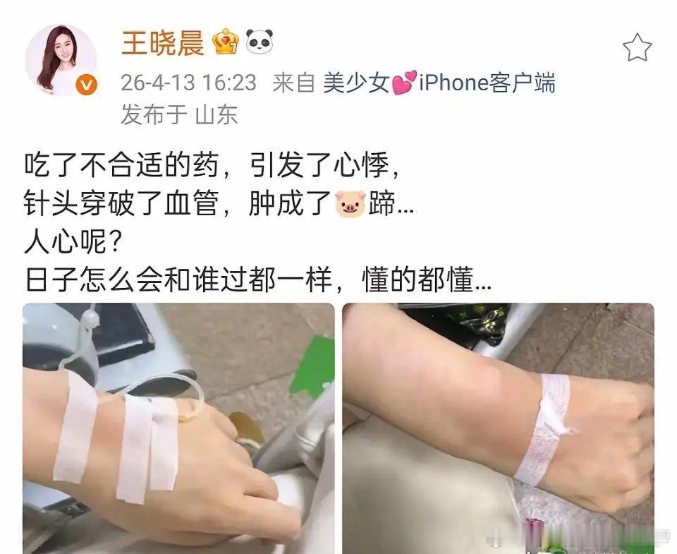 俞灏明的老婆为什么总是这么作妖？输液针头刺破血管也是常有的事，应该找护士。怎么又