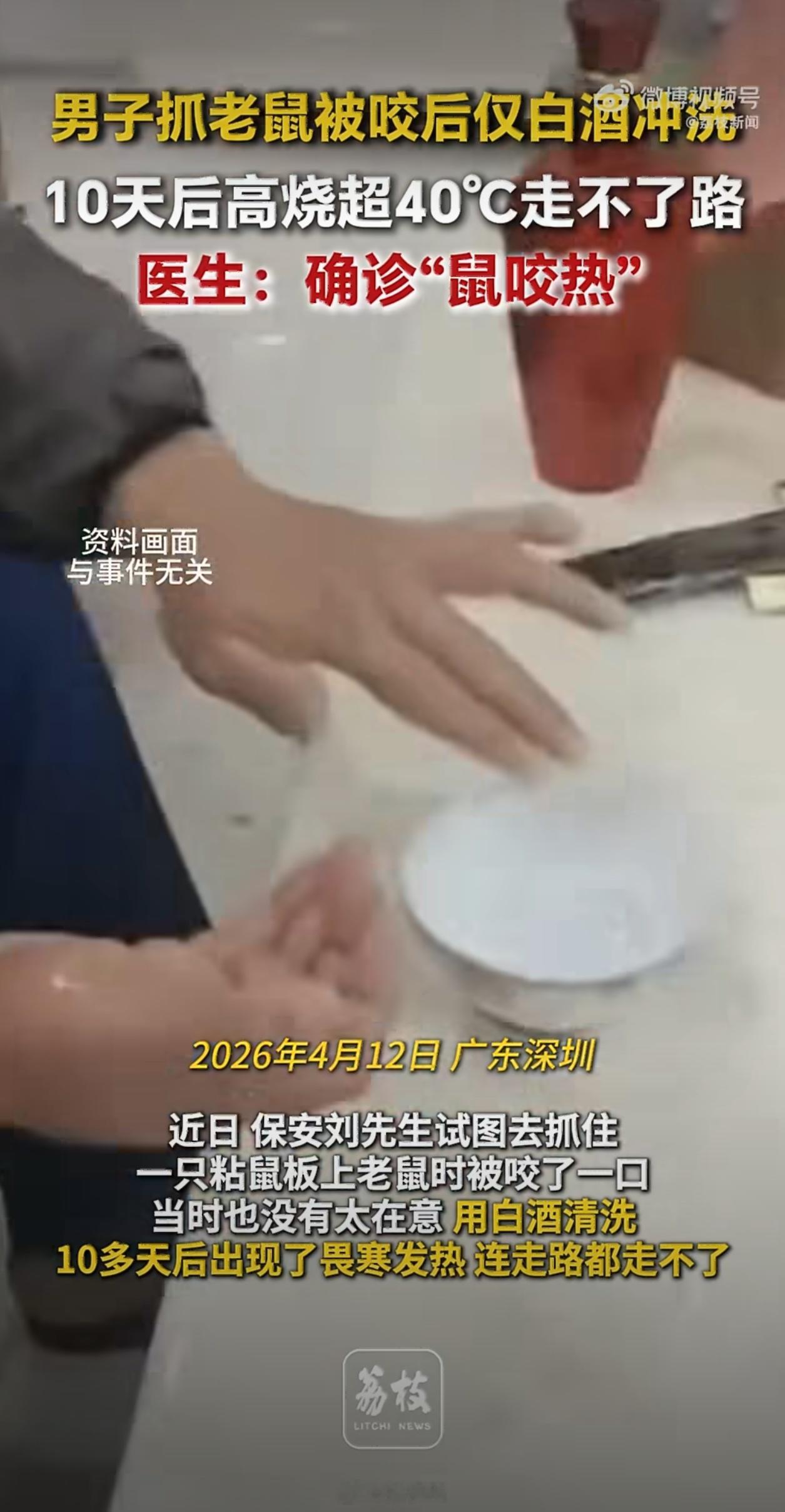 被老鼠咬10天后确诊鼠咬热心也太大了，还好不是鼠疫。被动物咬伤后一定要及时去医院