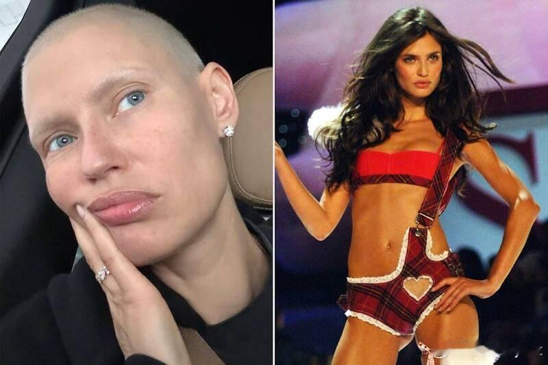 【维密大秀标榜多元包容，却拒绝“抗癌天使”巴尔蒂登台引发争议】海外新鲜事 曾为“