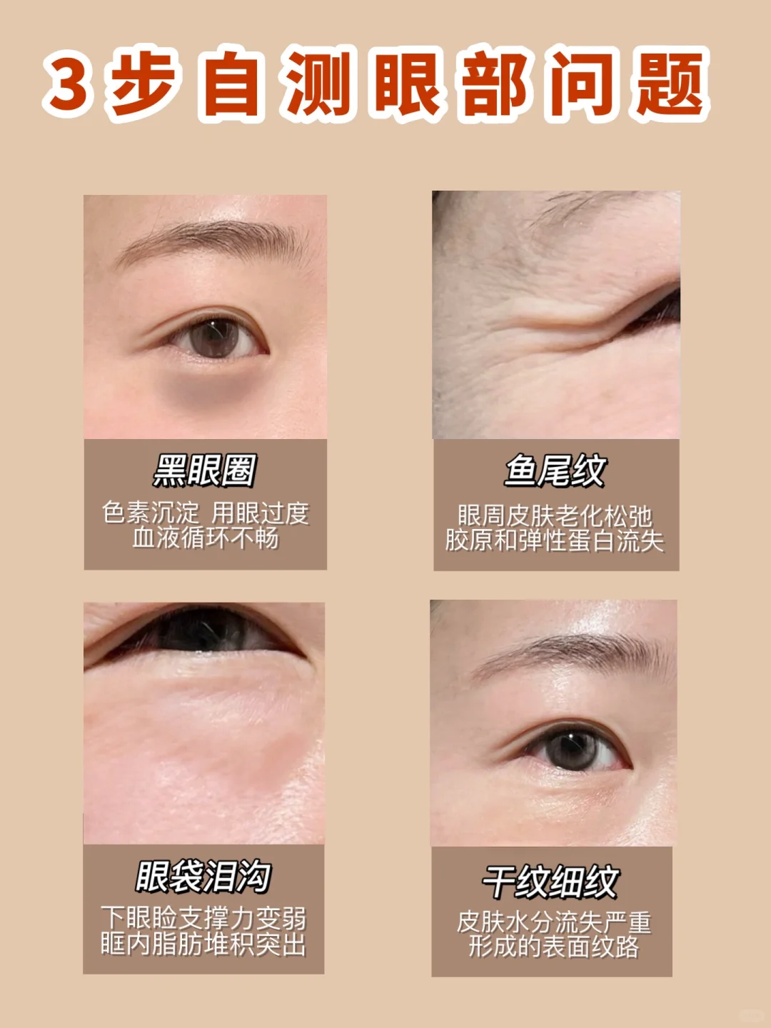 可怕！补觉也救不了眼周这些问题？