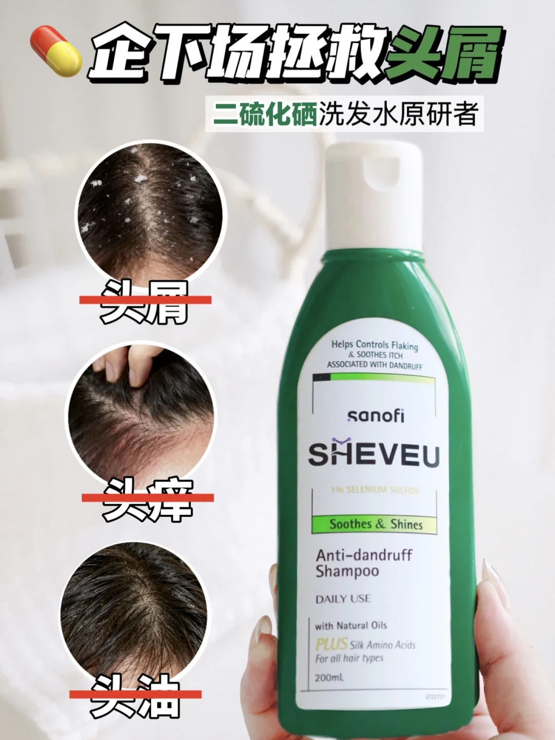 💊企下场救头屑！敏皮别再瞎买洗发水了！！