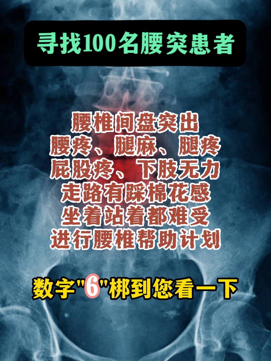 腰椎间盘突出 医学科普 骨科医生赵毅