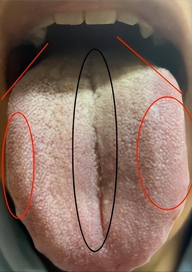 男人大腿根潮湿、明明是下焦湿热，为什么二妙丸没用？

来看这个粉丝的症状：
大腿