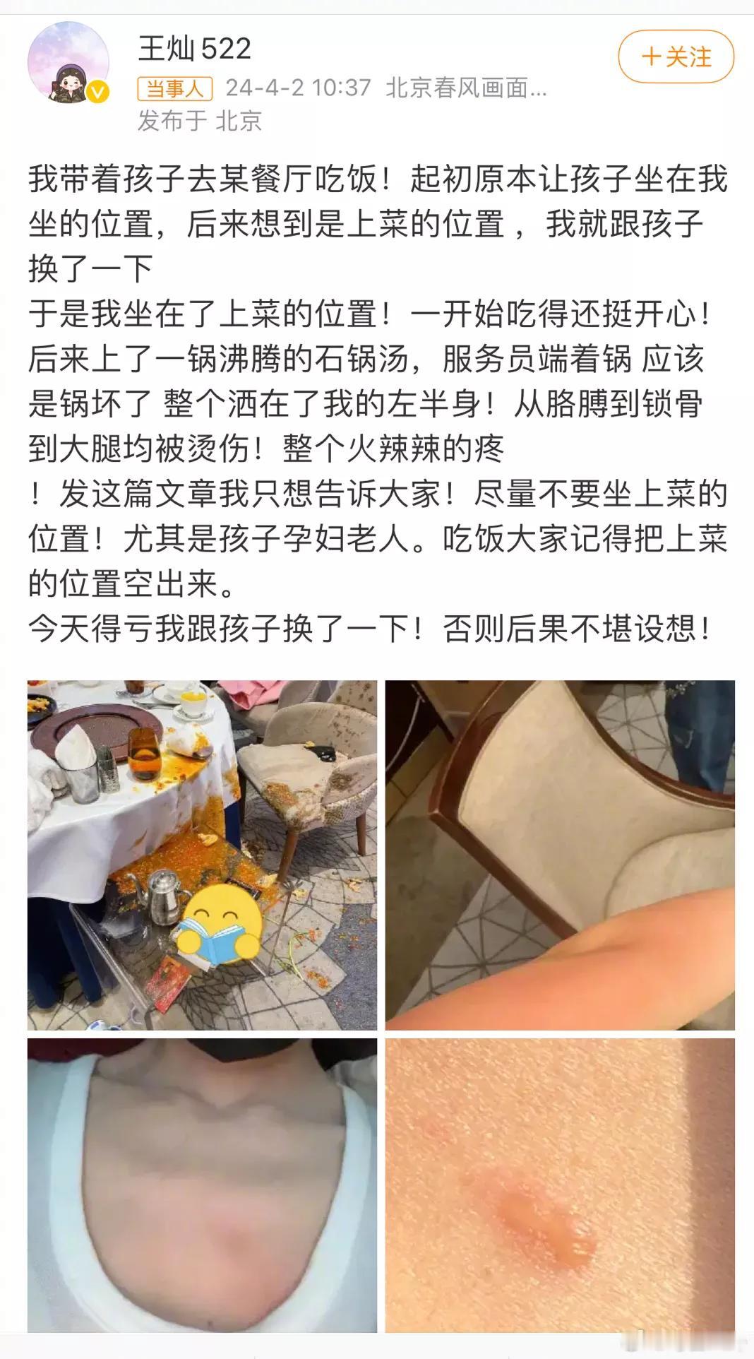 这得多疼啊
杜淳携老婆王灿外出就餐出现意外
搞得不欢而散场
皮肤上明显被烫出了水