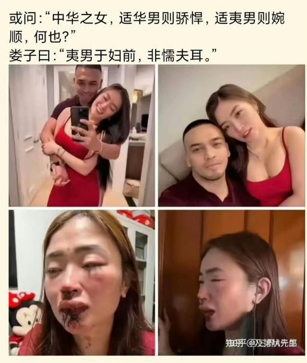 还是西药见效快！[呲牙][呲牙][呲牙]