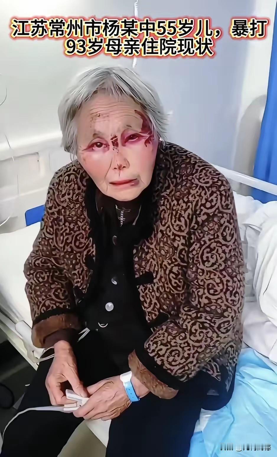 93岁老人被不孝之子暴打，深层次的原因，都是从小过度溺爱、过度浇灌所致。老人的儿