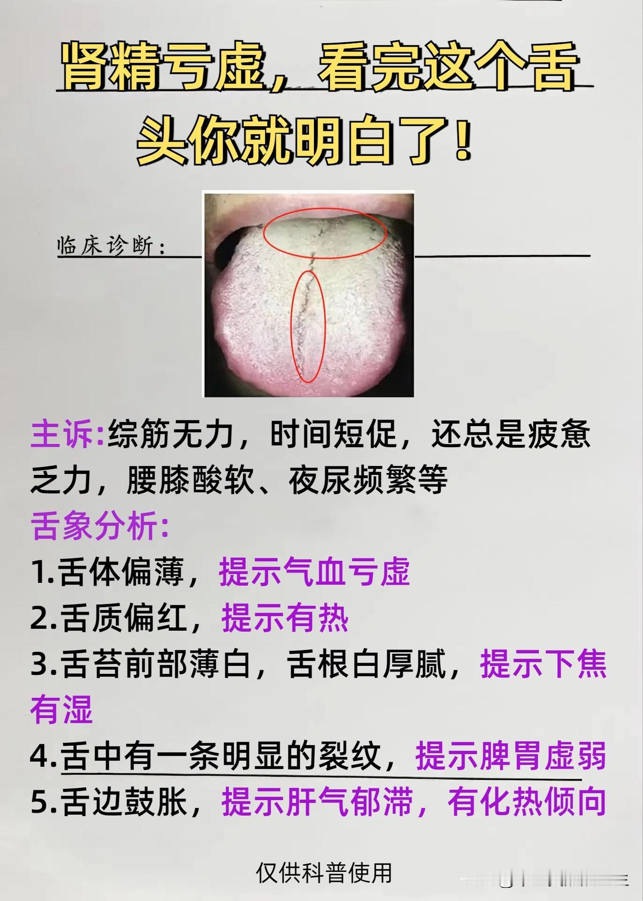 肾精亏虚，看完这个舌头你就能明白，为什么补药越吃越虚还上火！
患者的主诉是宗筋无