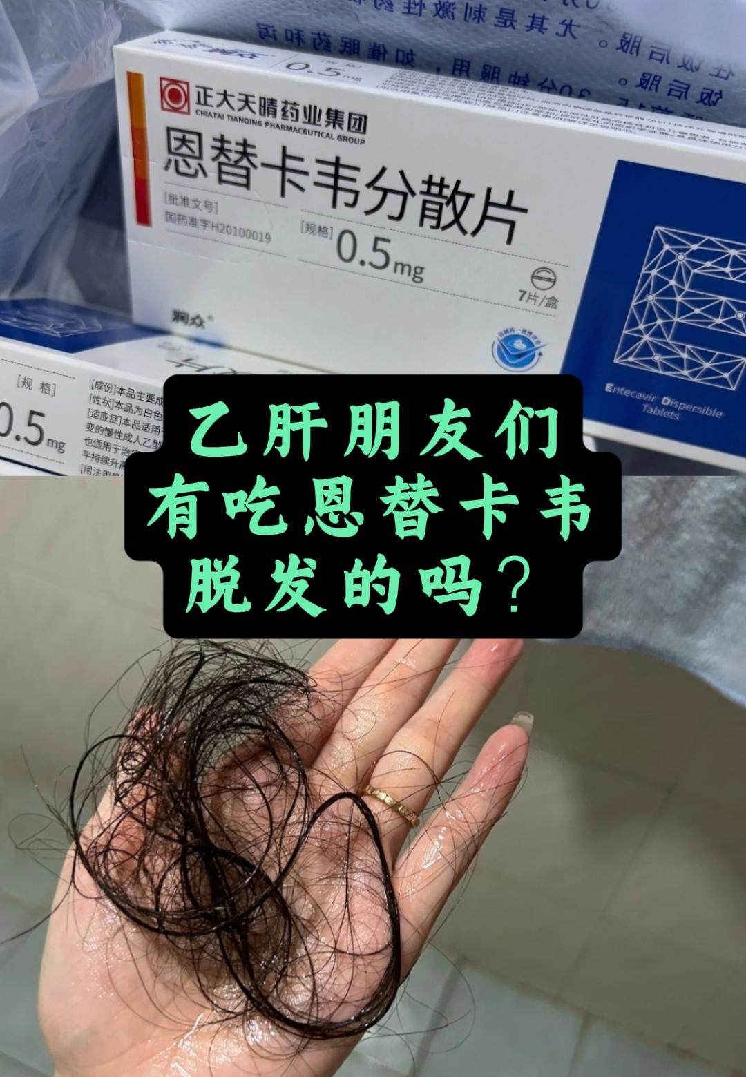 乙肝朋友们，有吃恩替卡韦脱发的吗？前几天专家门诊上有位患者出现了这样的...