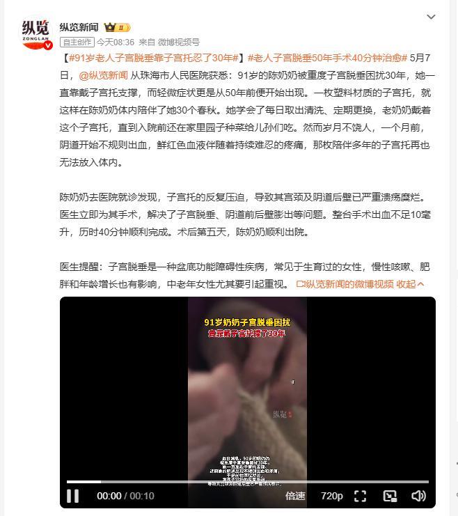 91岁老人子宫脱垂靠子宫托忍了30年 91岁陈奶奶重度子宫脱垂30年，靠一枚塑料