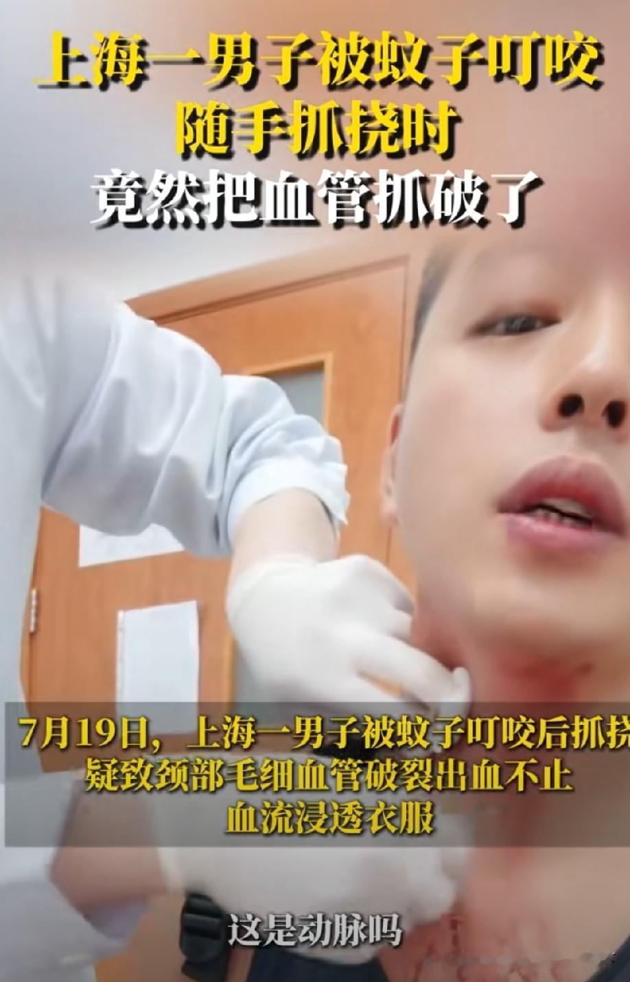 蚊子没这个能力吧[what]
要是都这样，随便一只蚊子都能搞死人[捂脸]