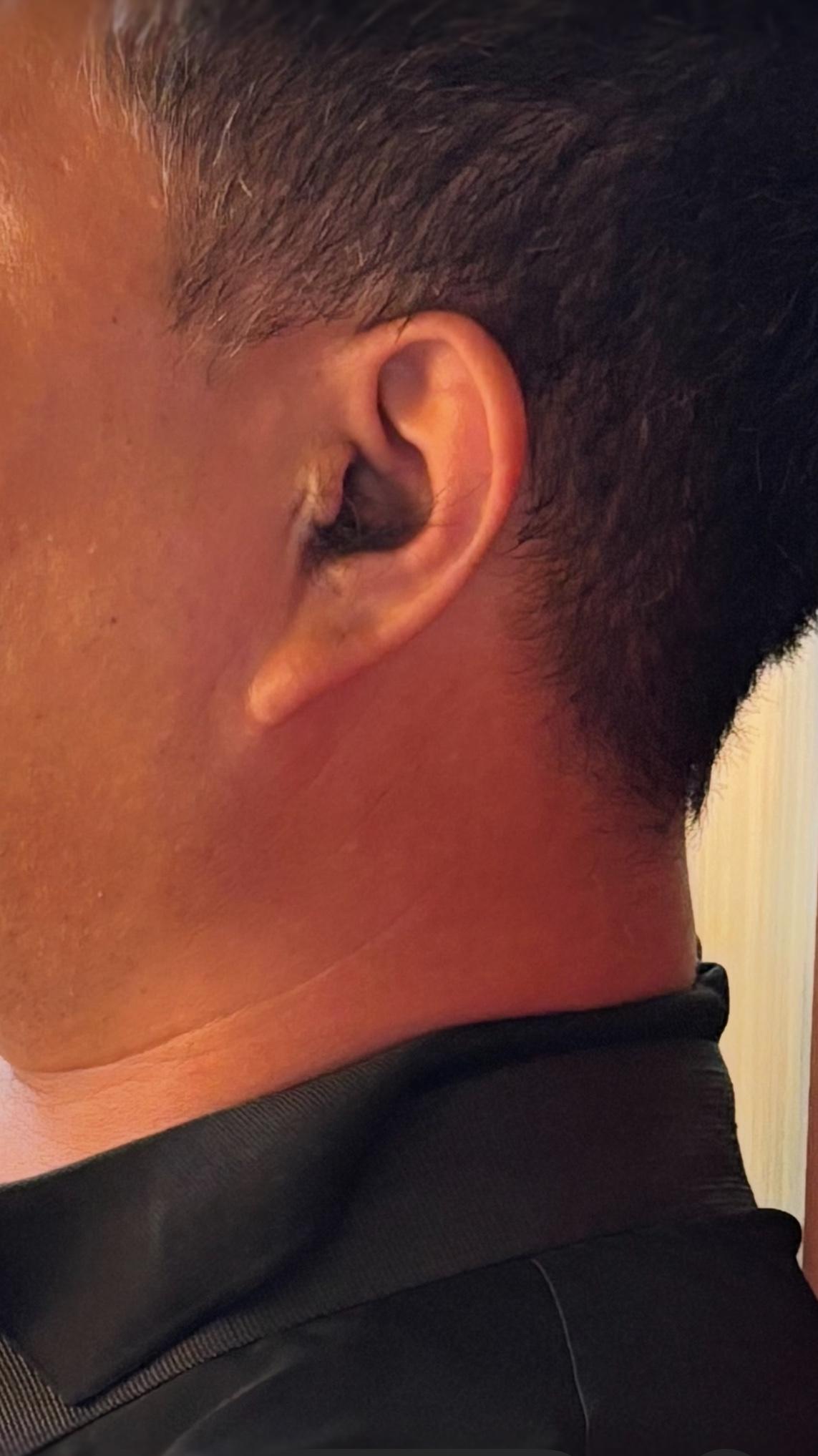 有没有人知道，为什么男人在40岁以后耳朵会长毛？

第一次见到耳朵长毛，是我的老