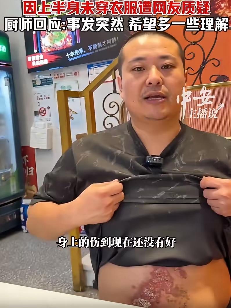 男厨师赤裸上身急救卡喉女子被网友们质疑，得知消息后他本人出面回应：身上烫伤没好，