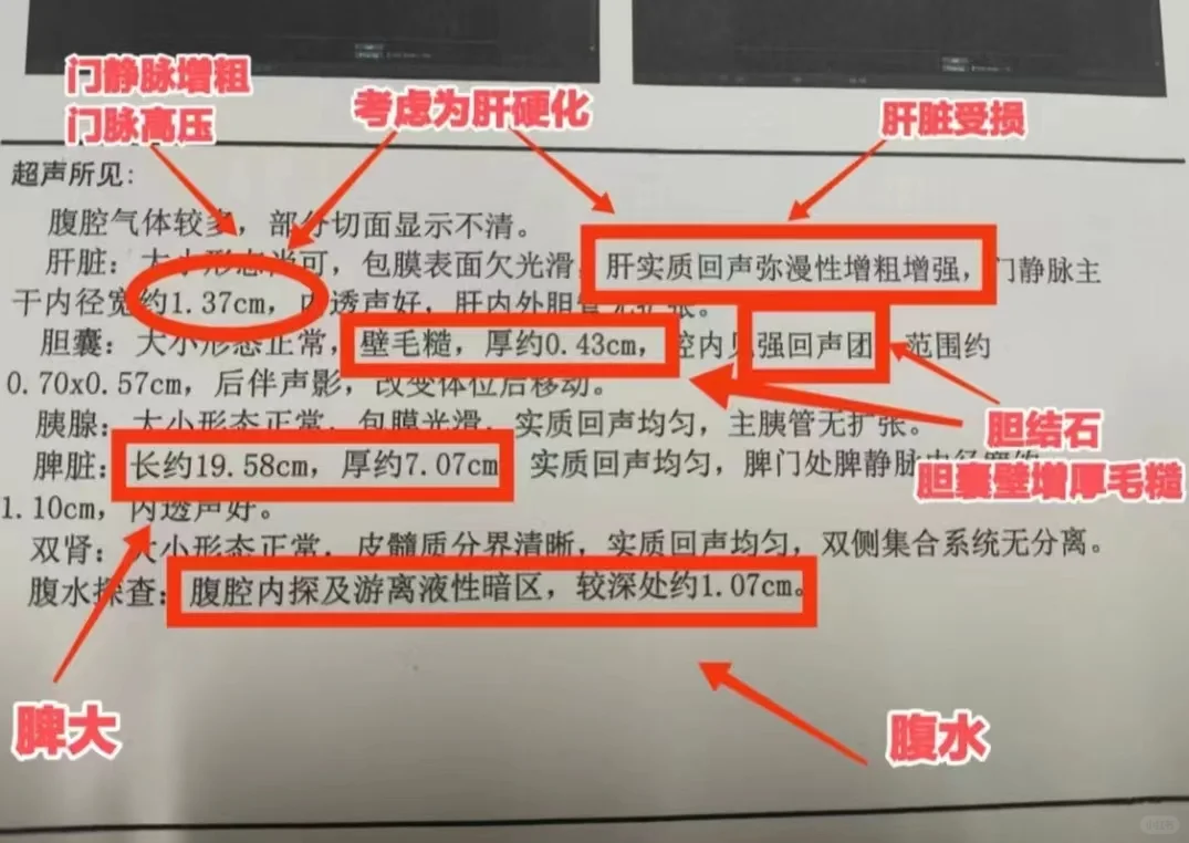 肝脏彩超怎么看？