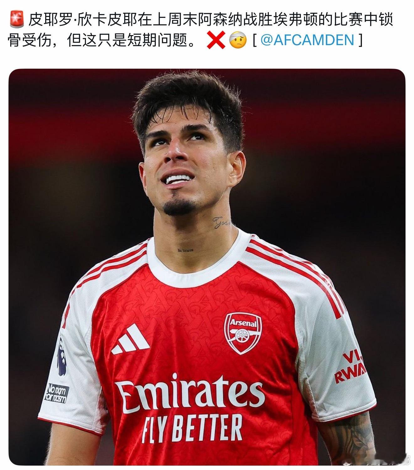 锁骨受伤有可能是纹身的时候扎重了阿森纳阿森纳