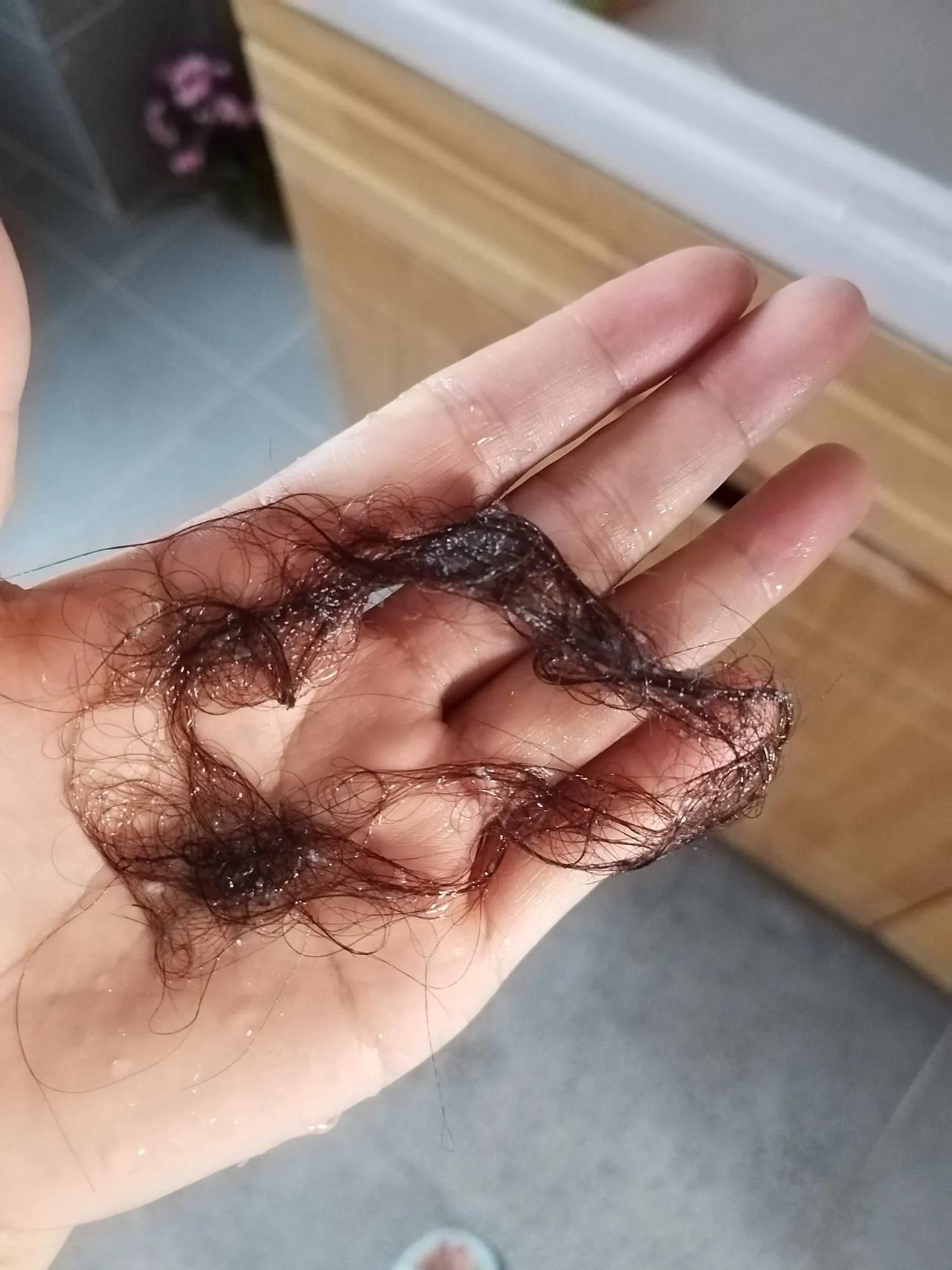 为什么女人到了这年龄会不停的掉头发？
这是刚刚擦完地毛巾上沾的，这都是从我头上掉