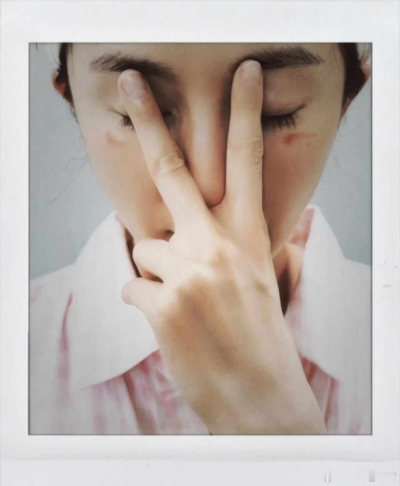 杨幂脸被蒸汽眼罩烫伤了杨幂的脸受伤了，大美女居然被蒸汽眼罩咬了。眼部的烫伤好明显