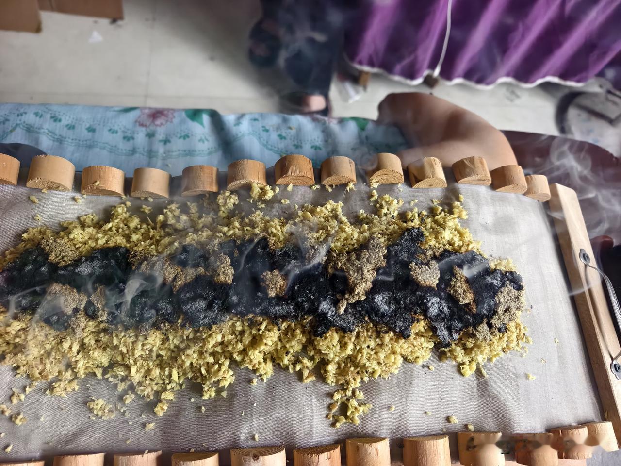 艾灸上火的原因？
第1个没有辩证配点位，胡乱烧烤式的艾灸
第二，艾灸条直径选的过