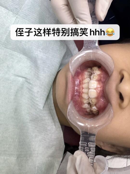 一点📒儿童牙齿健康知识分享 	 自从发现侄子有蛀牙，带她去磨了蛀牙...