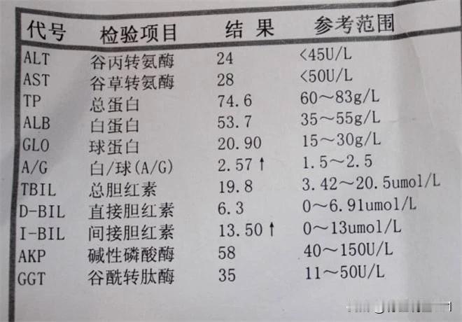 肝功能检查，看这4点就够了

在现代社会，随着生活节奏的加快和不良生活习惯的增多