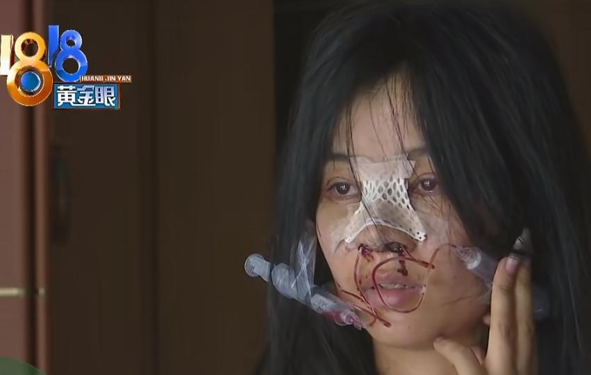 太坑了！浙江杭州，女子右手患血管瘤，需要20万元做手术，女子没钱，只好到KTV打