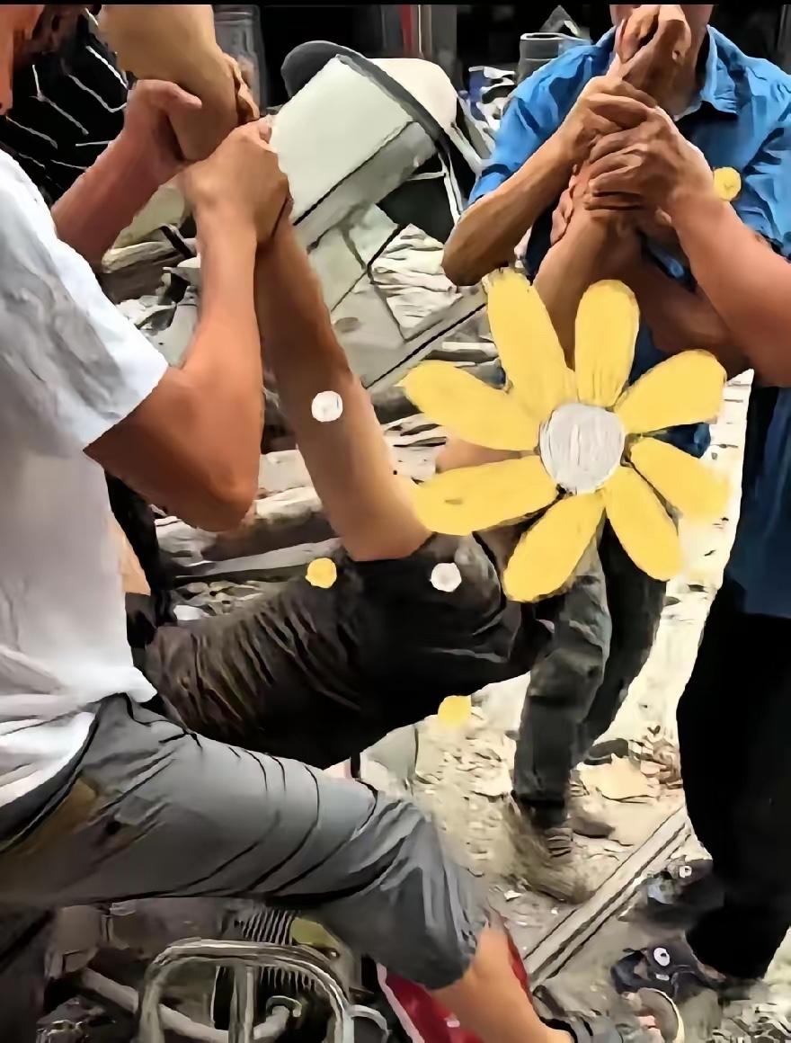 腿断了。但人活着。
废墟底下压了十九个小时，刨出来的时候，血糊了半张脸，腿拧成了