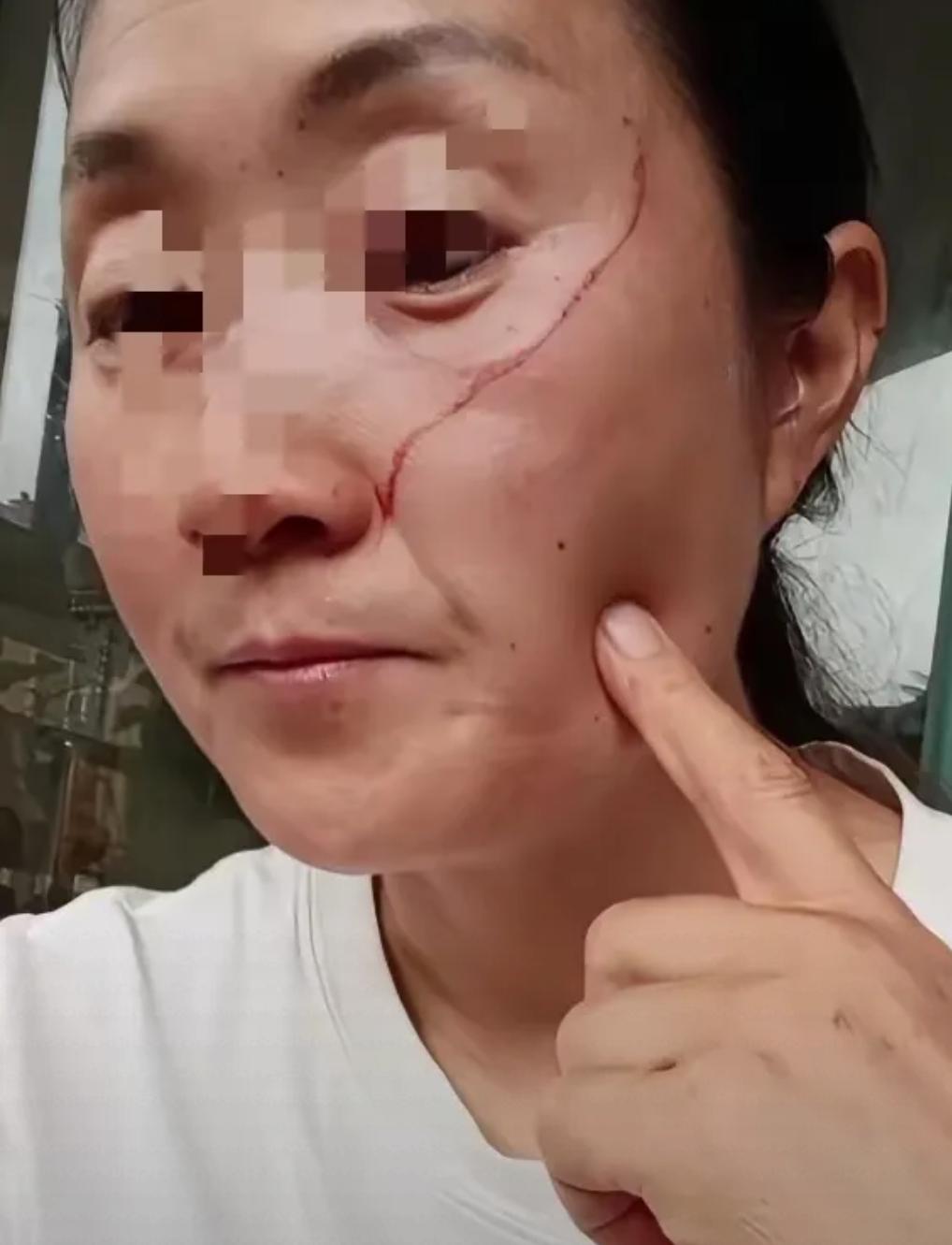 一言难尽！一位妈妈在网上哭诉。高考刚结束，中午她做了饭，把睡觉的女儿吵醒了。孩子