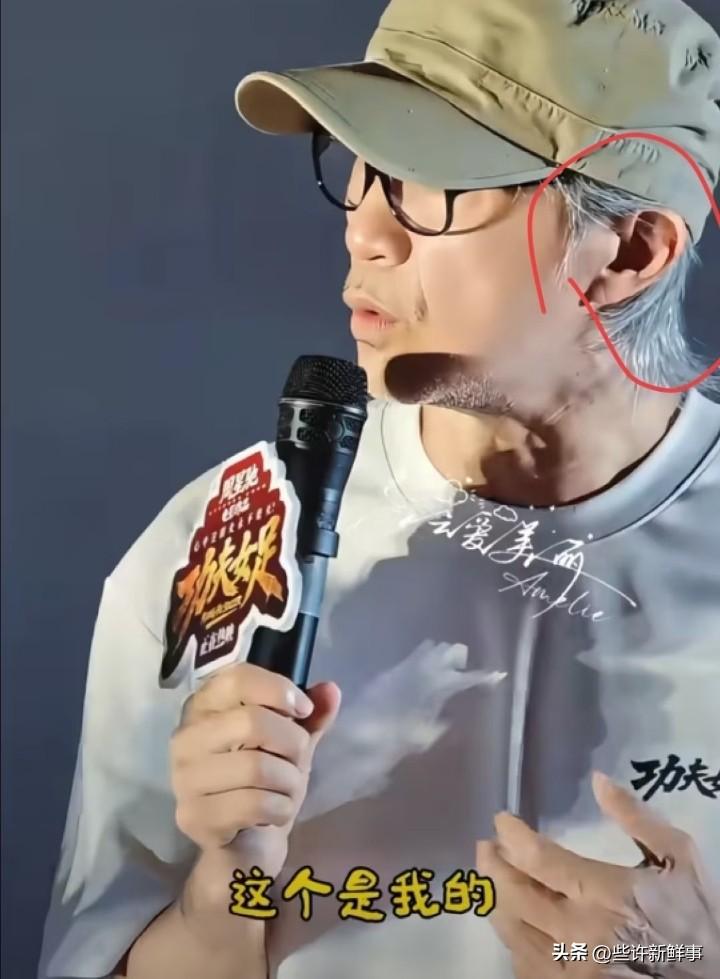 《星爷你耳朵怎么了》