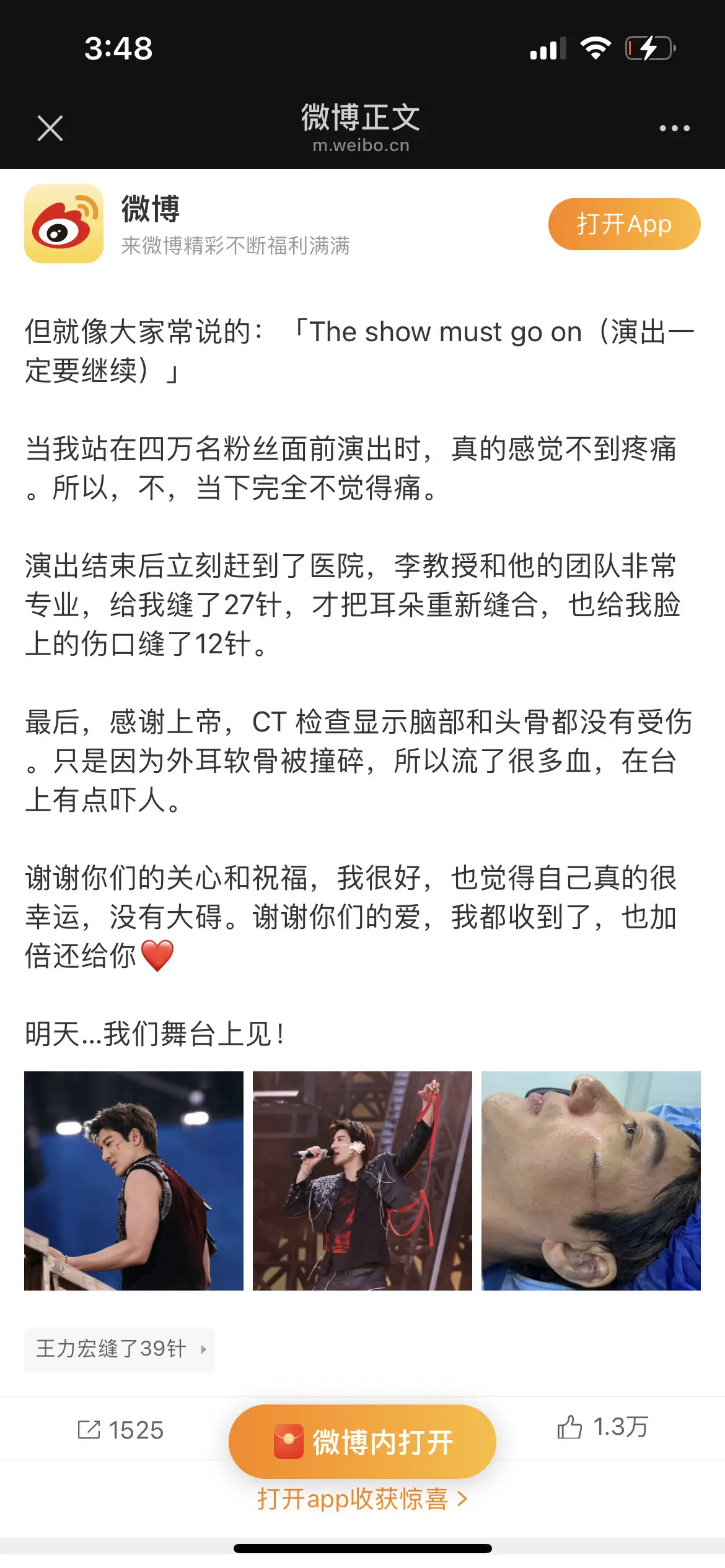 缝了39针。当时痛的连天地龙鳞都唱快了，太心疼了！