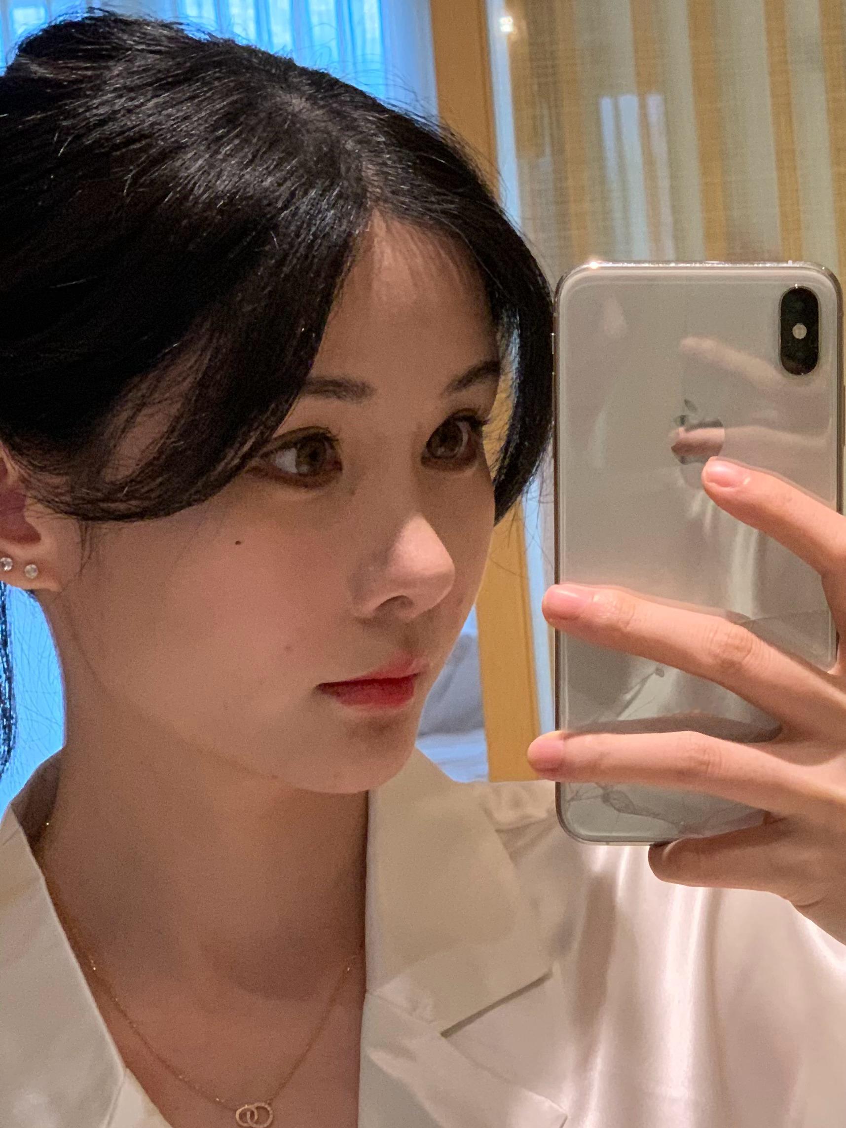 做轮廓第四年，我主要的是把颧弓推进去颧骨保留45度角，感觉这个是最抗老的做轮廓的